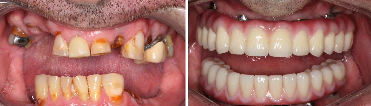 2 Jack K before and after (3)