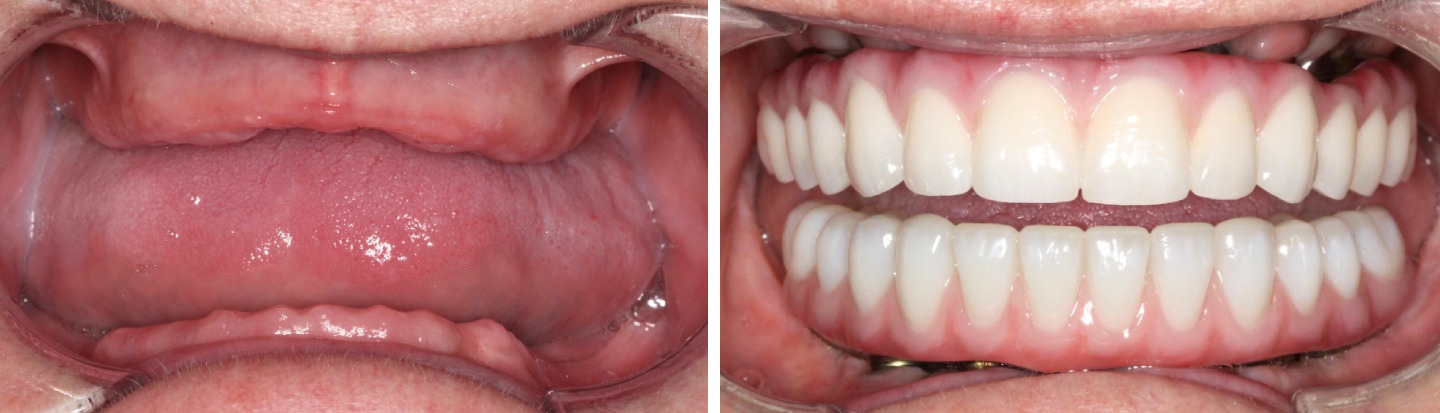 3 Donna Allen before and after