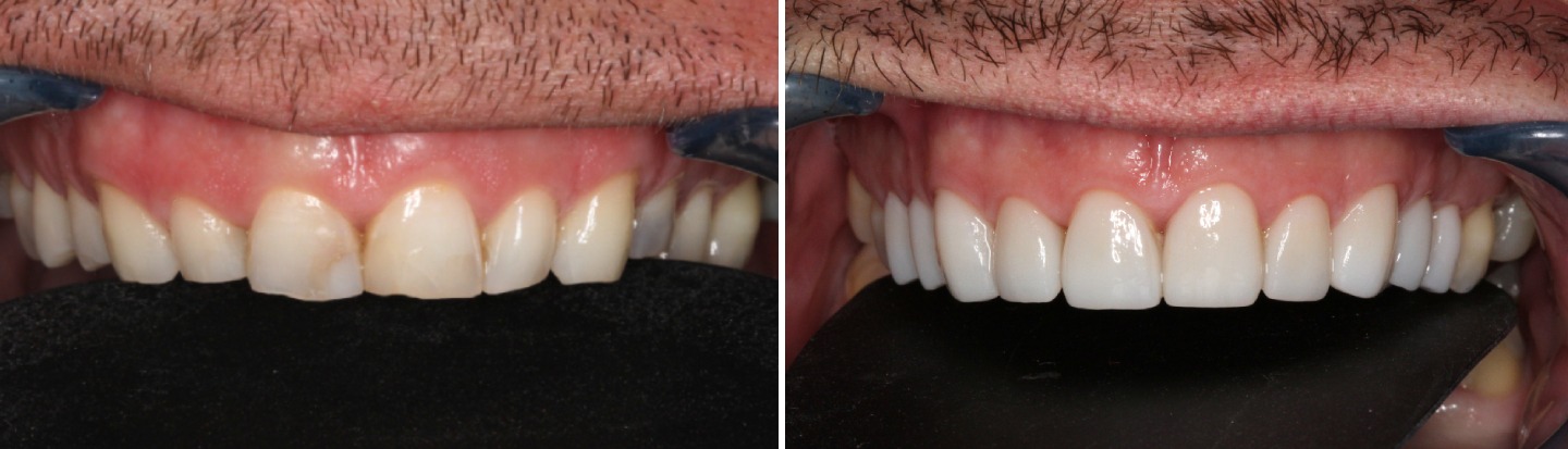 Daniel Davies before and after (1)