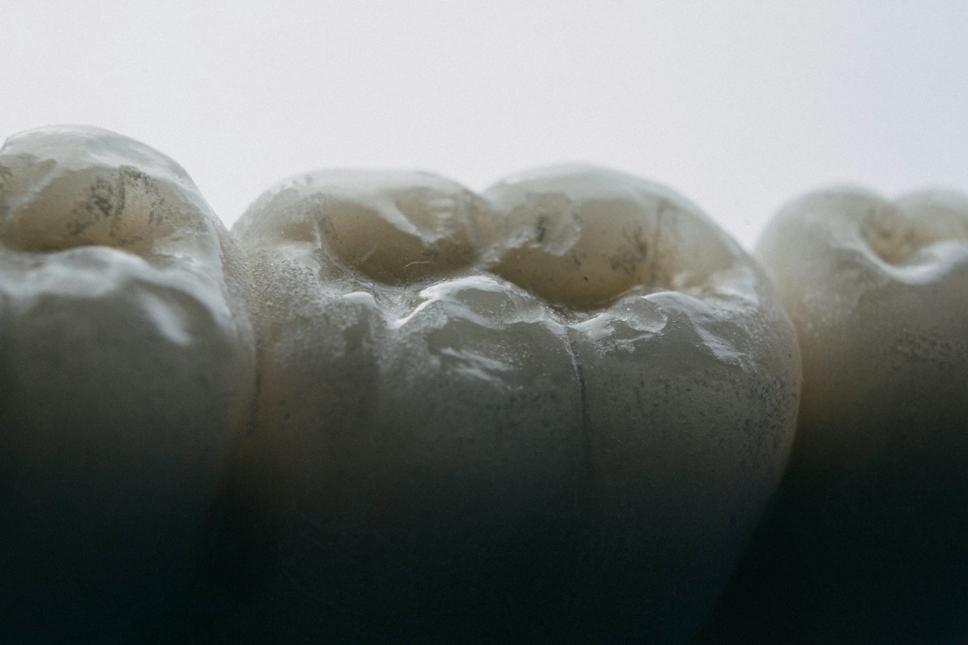 Are Metal Tooth Fillings Safe and Why Does the Mercury Debate Still Spark Questions?