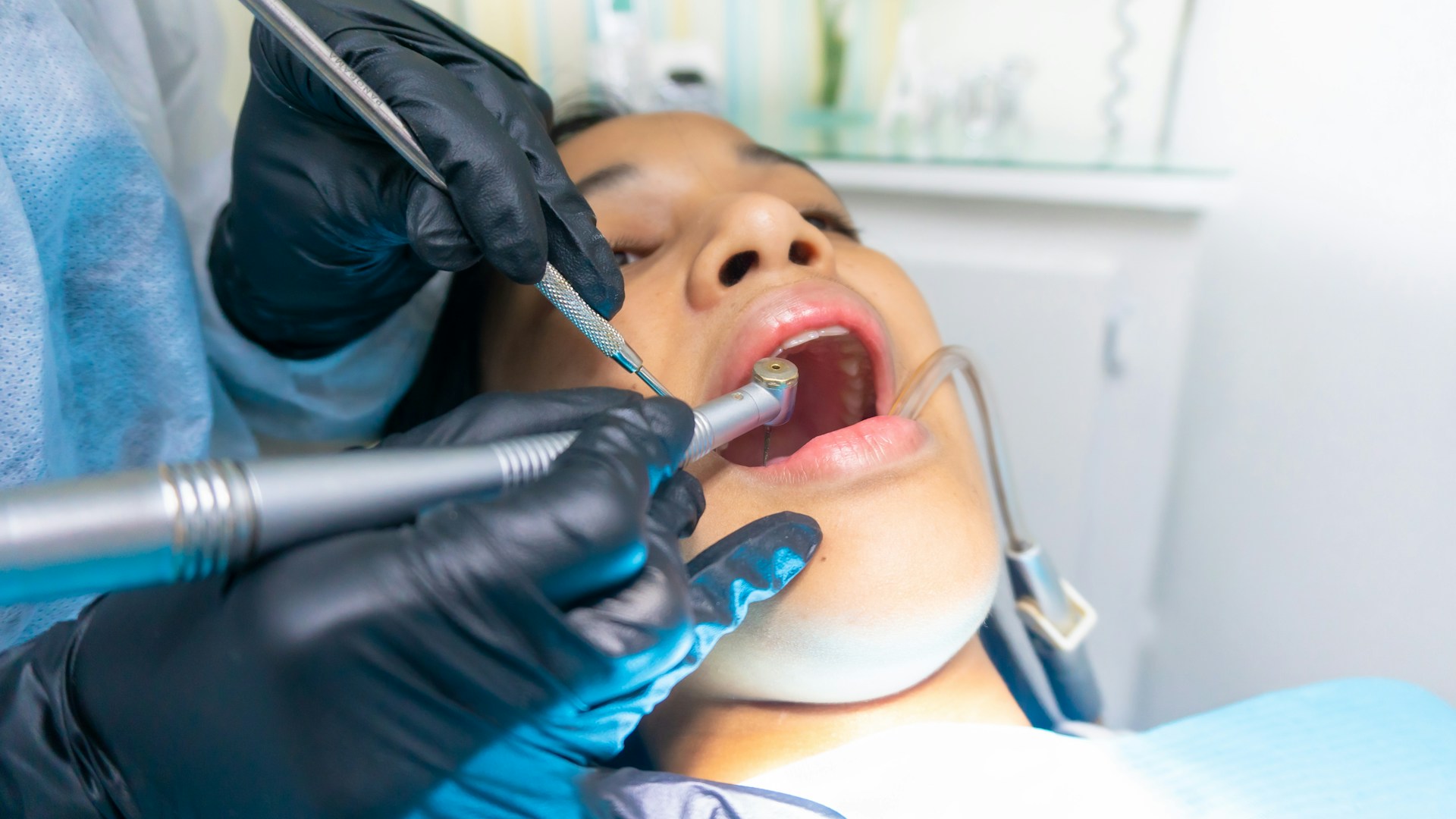 What Are Modern Tooth Fillings Made Of and Why Does It Matter More Than You Think?